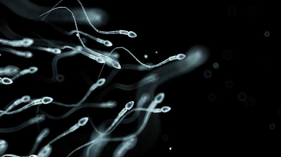 сперматозойды в движении