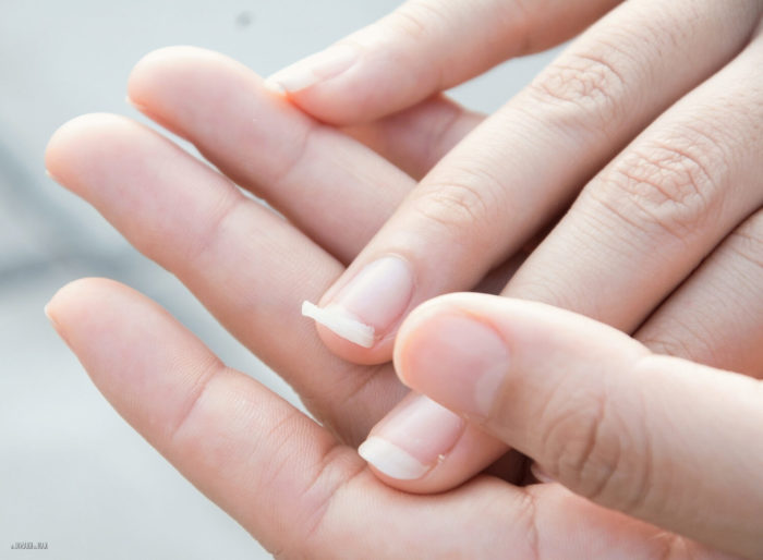Витамины для ногтей — какие нужны и как влияют